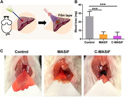 Light-Triggered Adhesive Silk-Based Film for Effective Photodynamic Antibacterial Therapy and Rapid Hemostasis